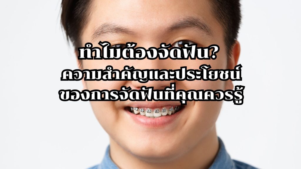 จัดฟัน