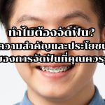 จัดฟัน